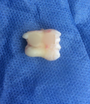 Clinical case: anatomical alteration