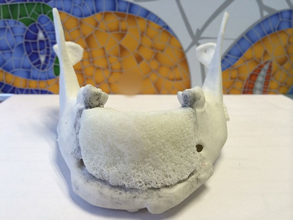 injerto para reconstrucción mandibular cdmx