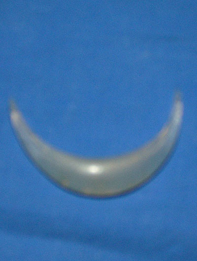 Retiro de implantes de Silastic por infección