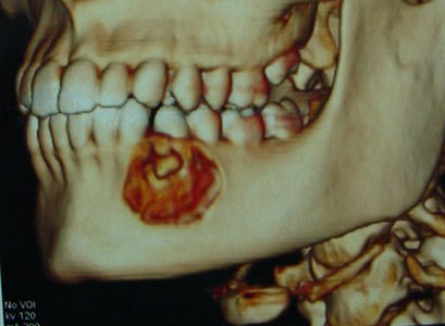 Seguimiento posterior