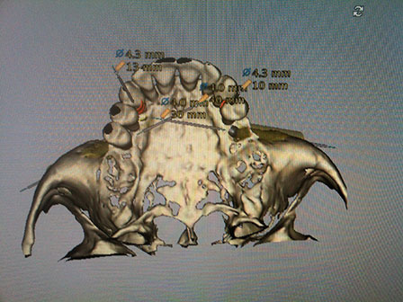 CAD CAM Cirujano Maxilofacial CDMX