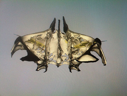 CAD CAM Cirujano Maxilofacial CDMX