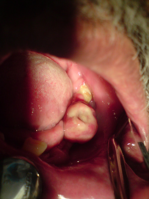 Cirugía Maxilofacial en México