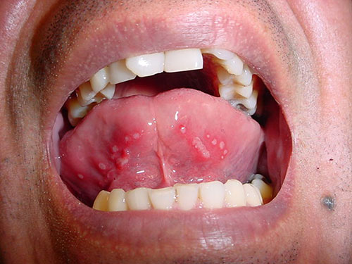 Maxilofacial CDMX