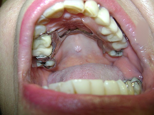Maxilofacial CDMX