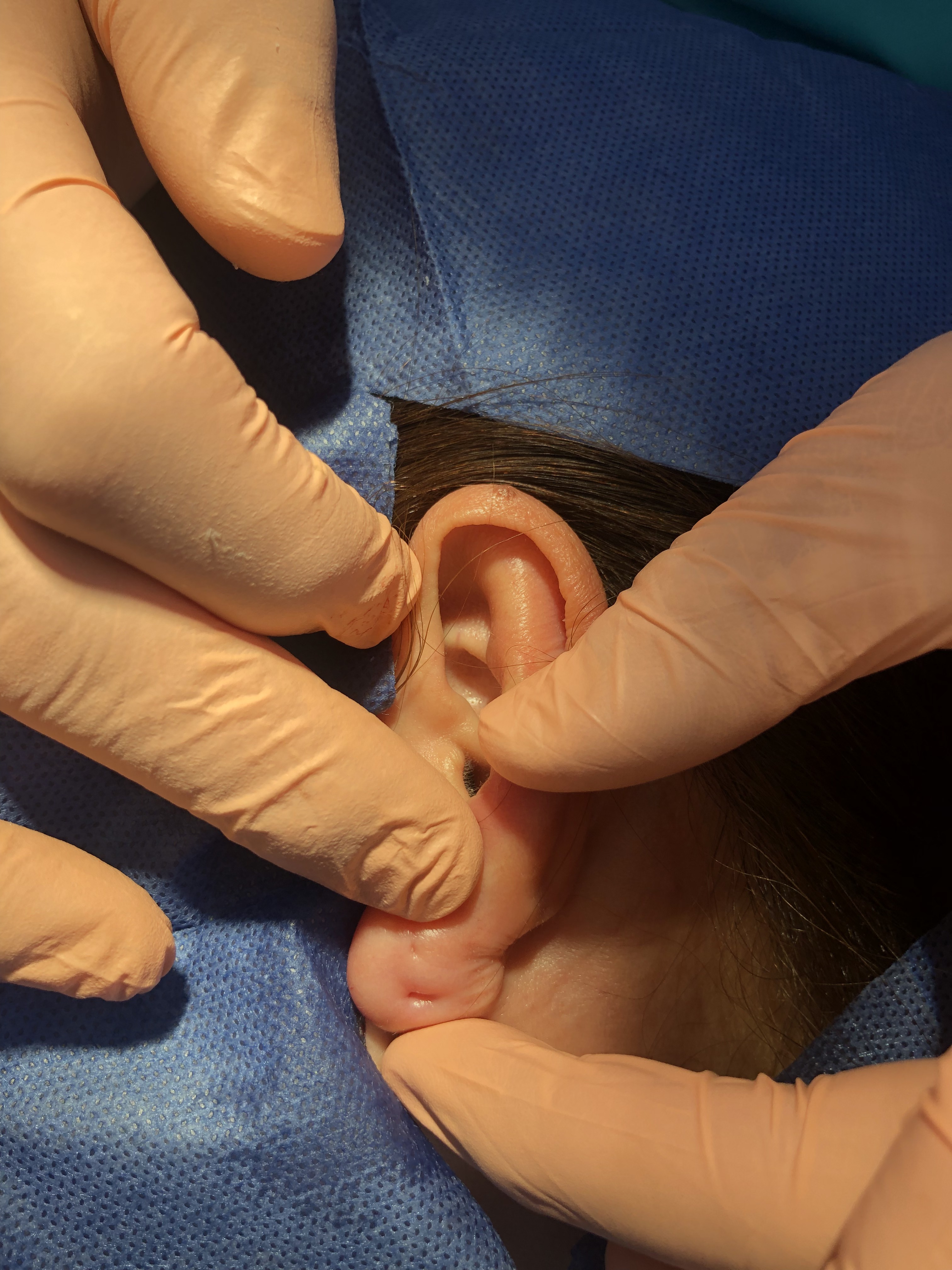 Ear piercing closure
