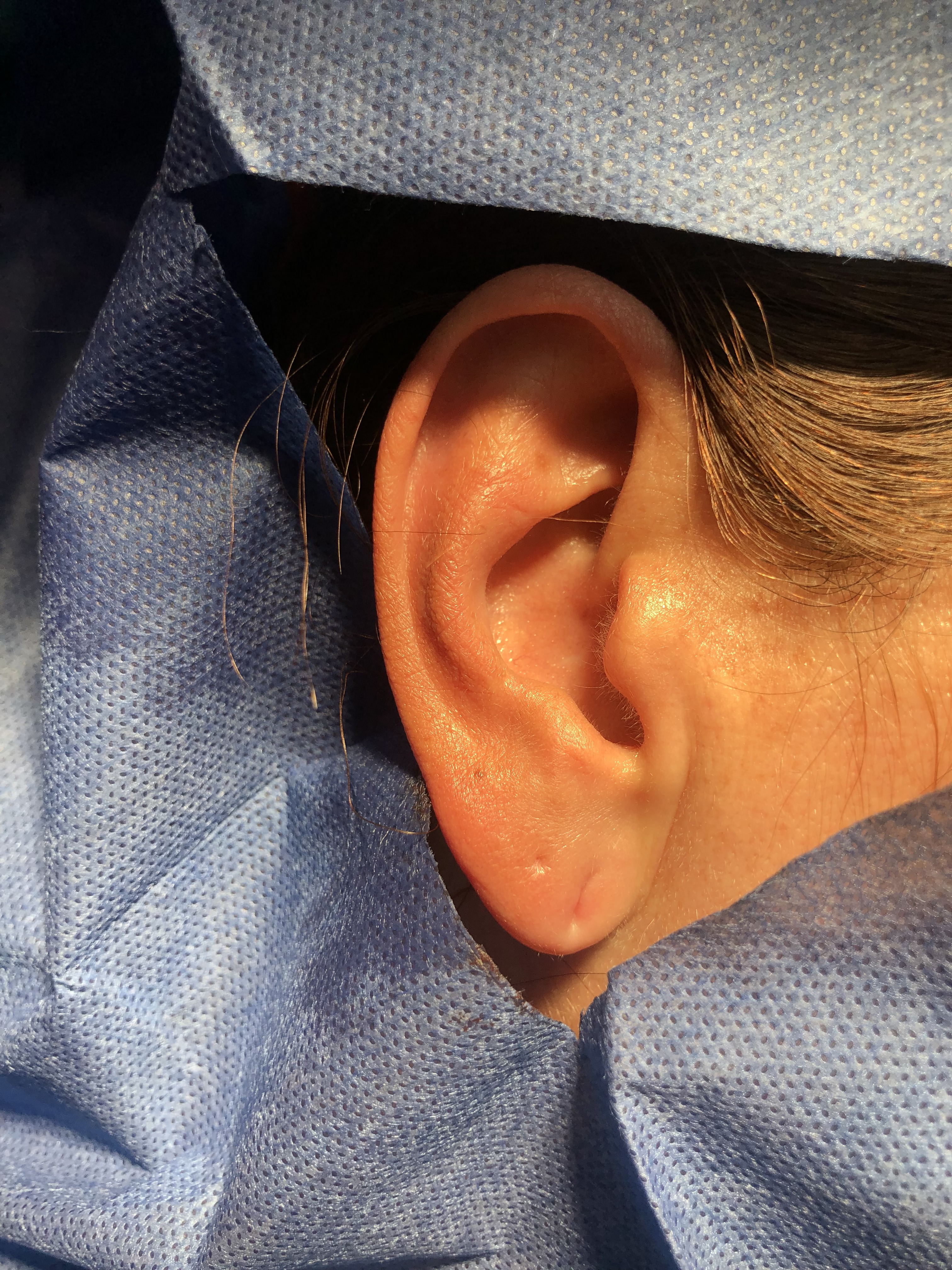 Ear piercing closure