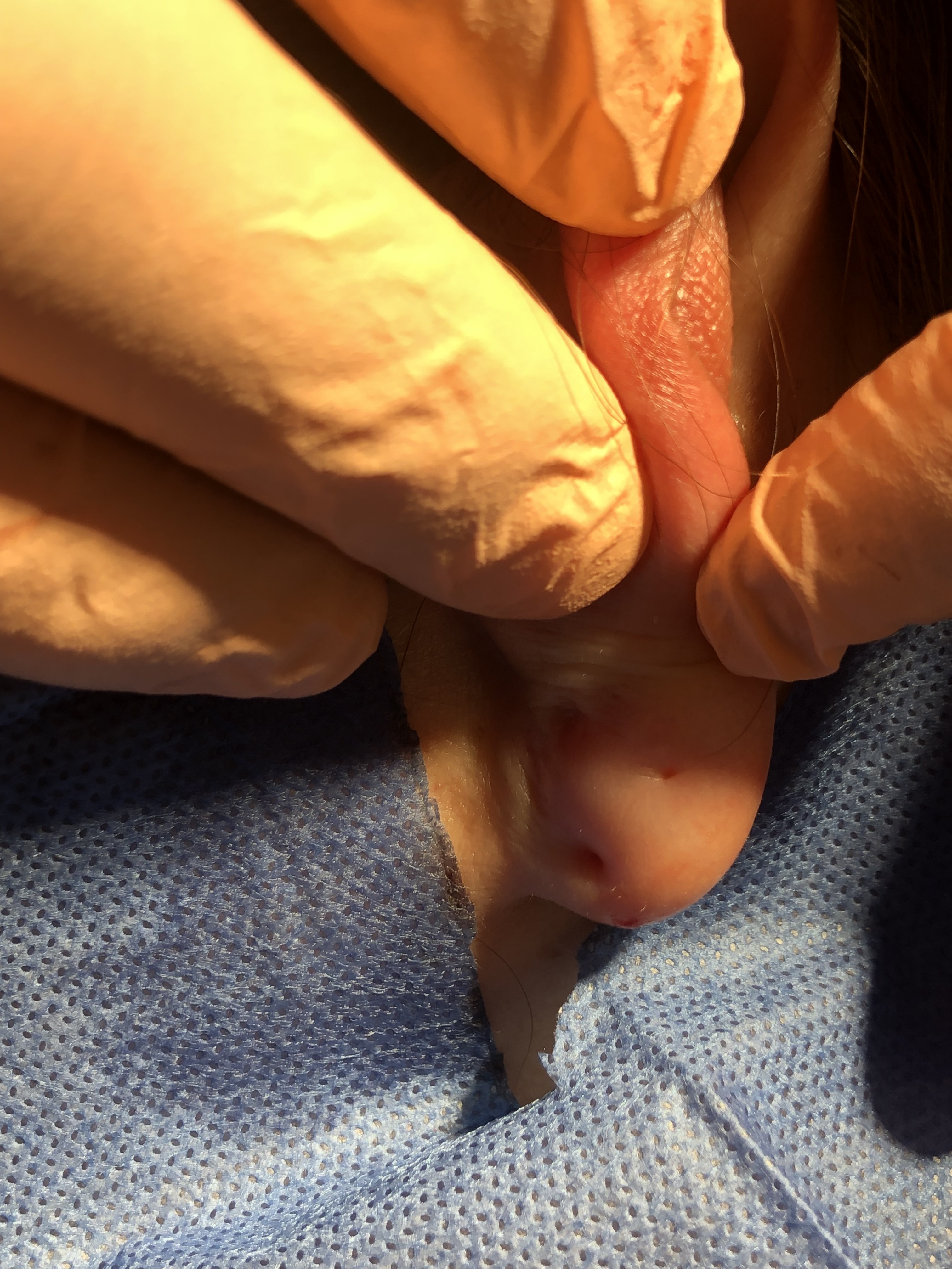 Ear piercing closure