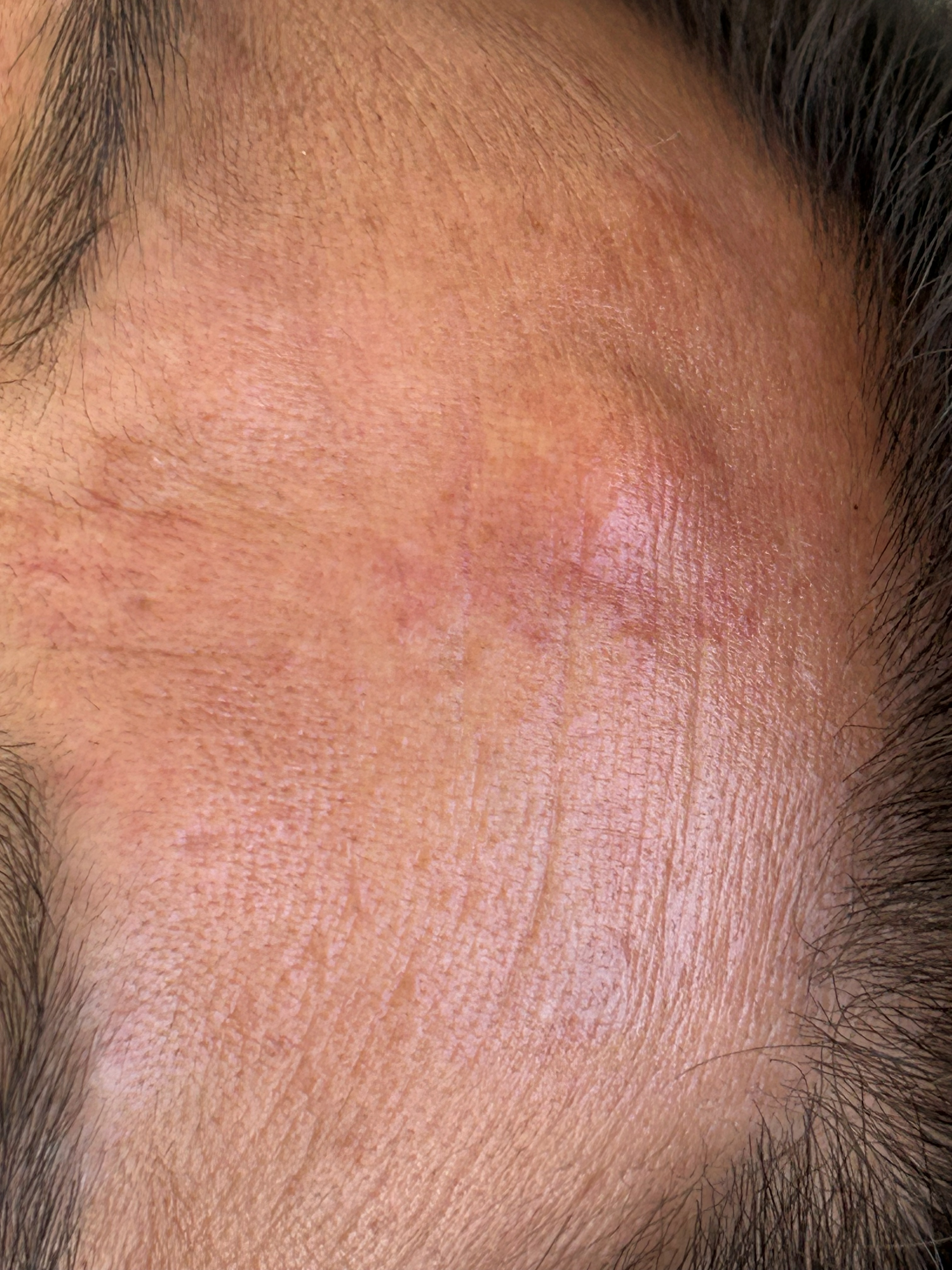 Antes
