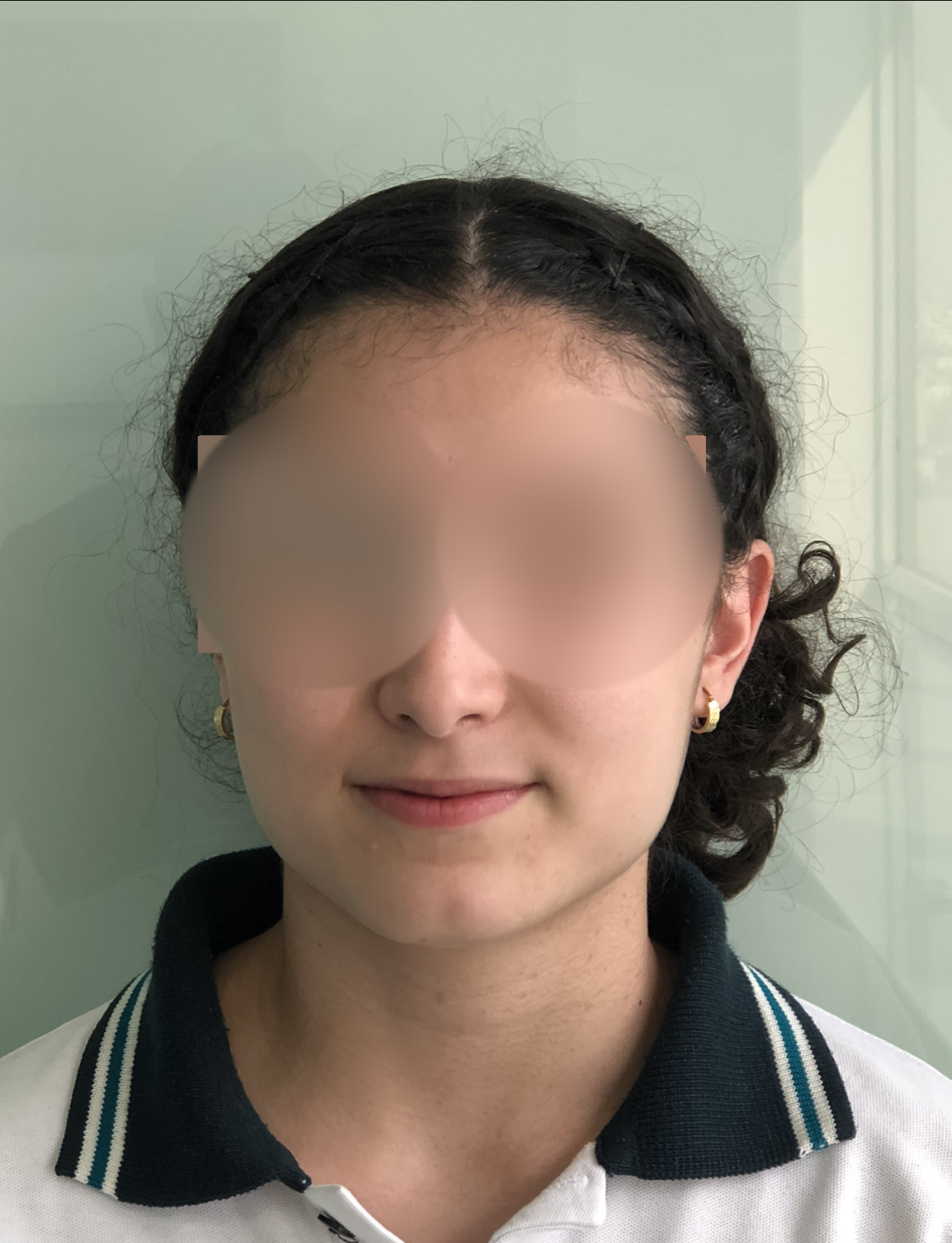 Antes