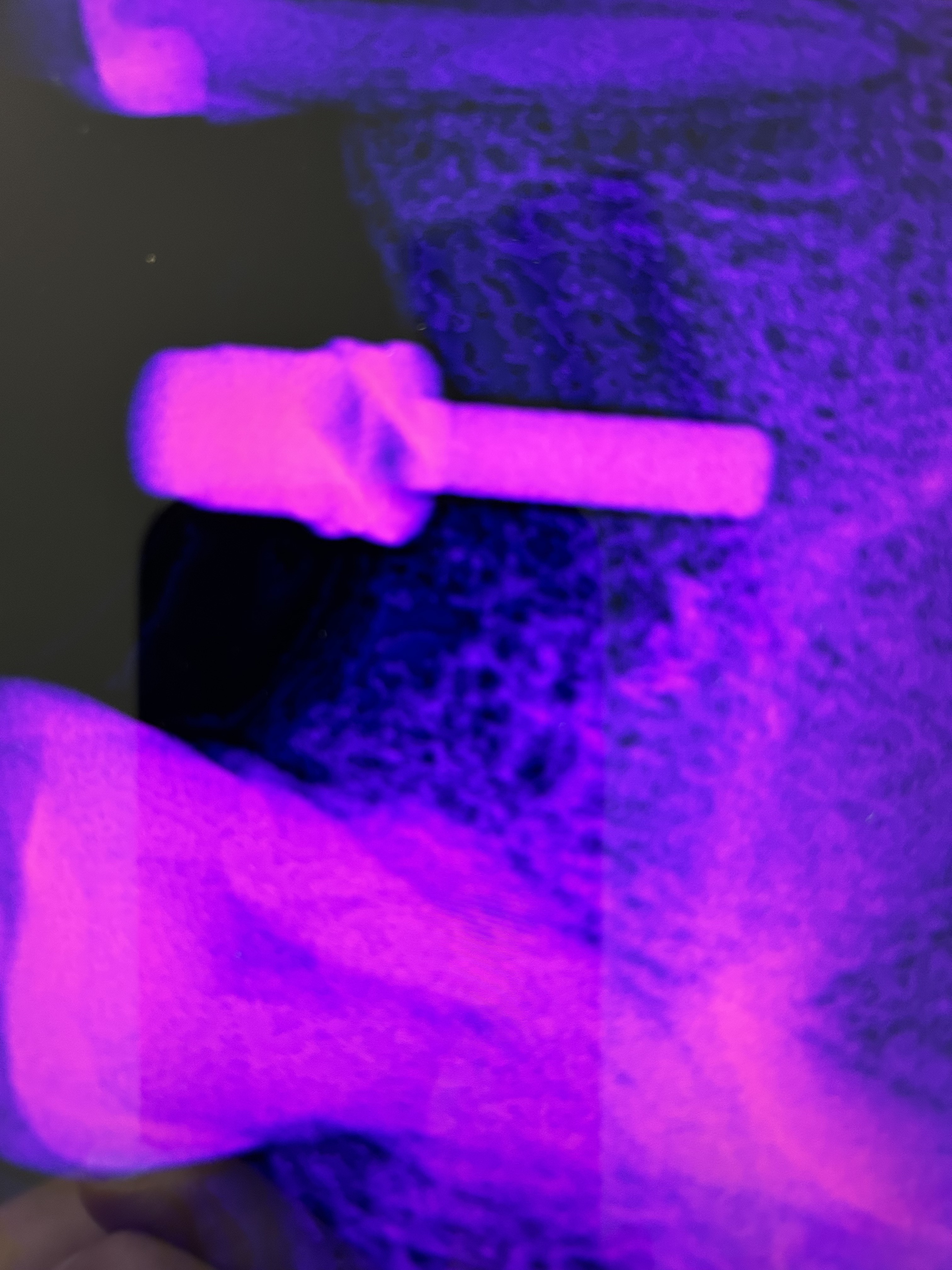 Implant at the maxillary sinus border