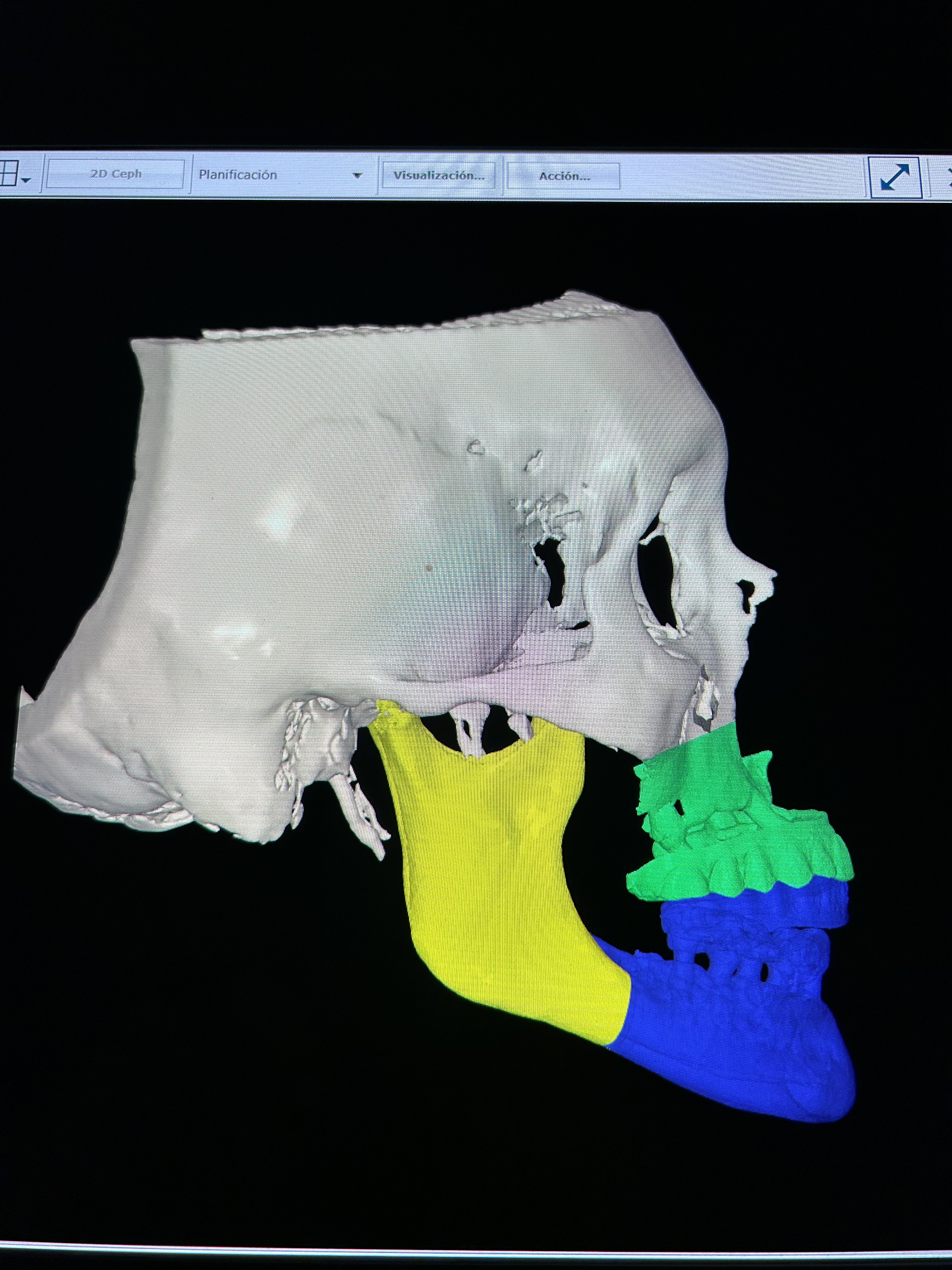 Clinical case 8