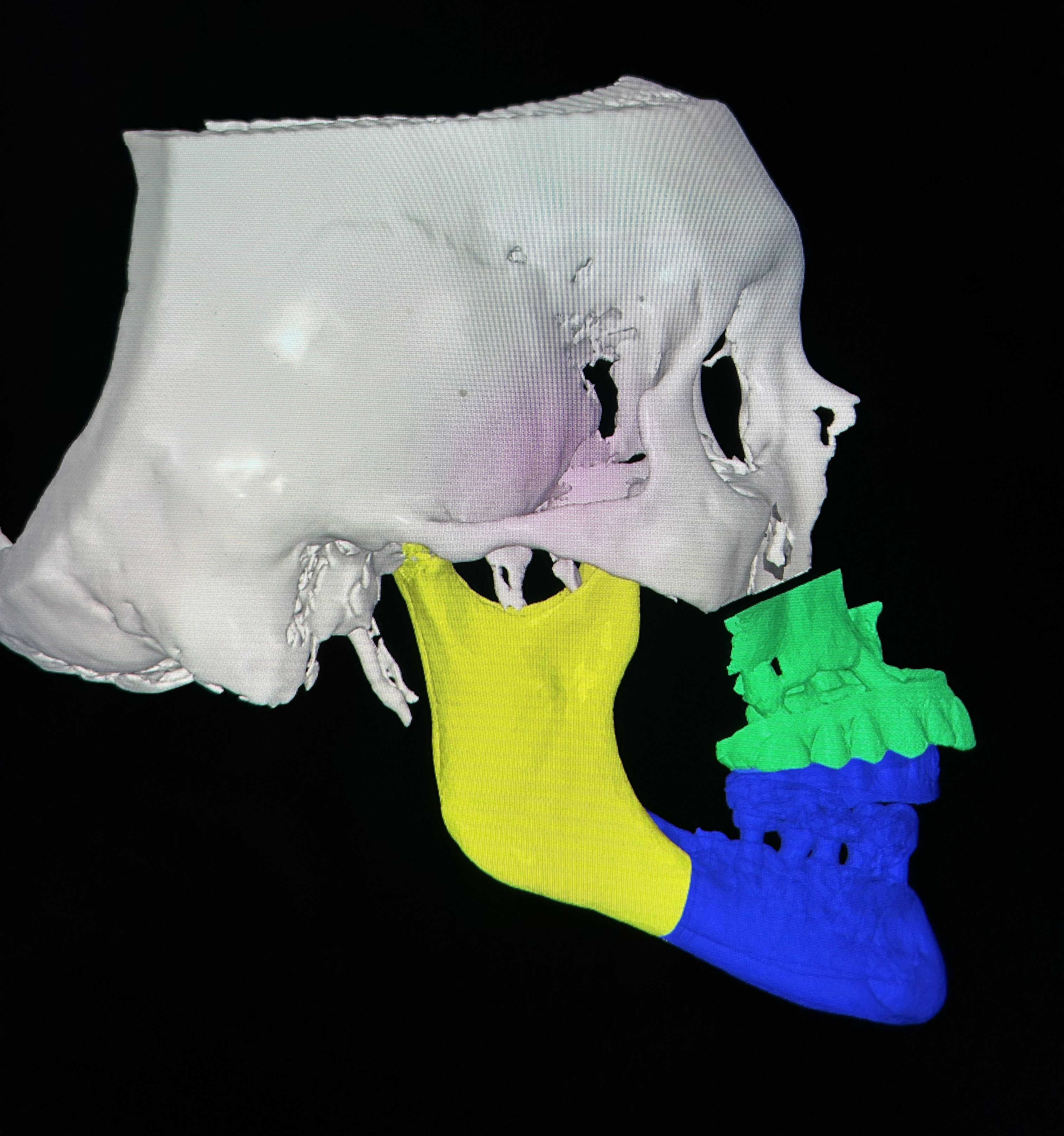 Clinical case 8