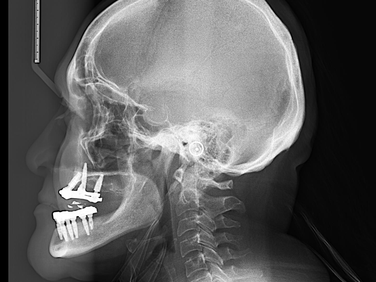 Clinical case 8