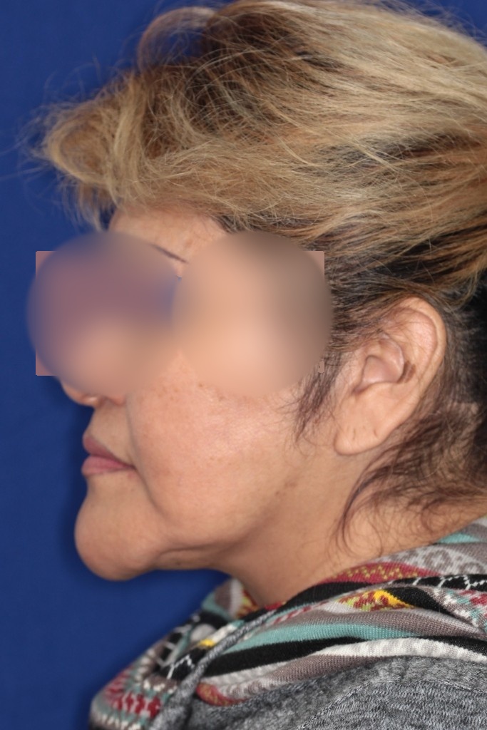 Clinical case 8