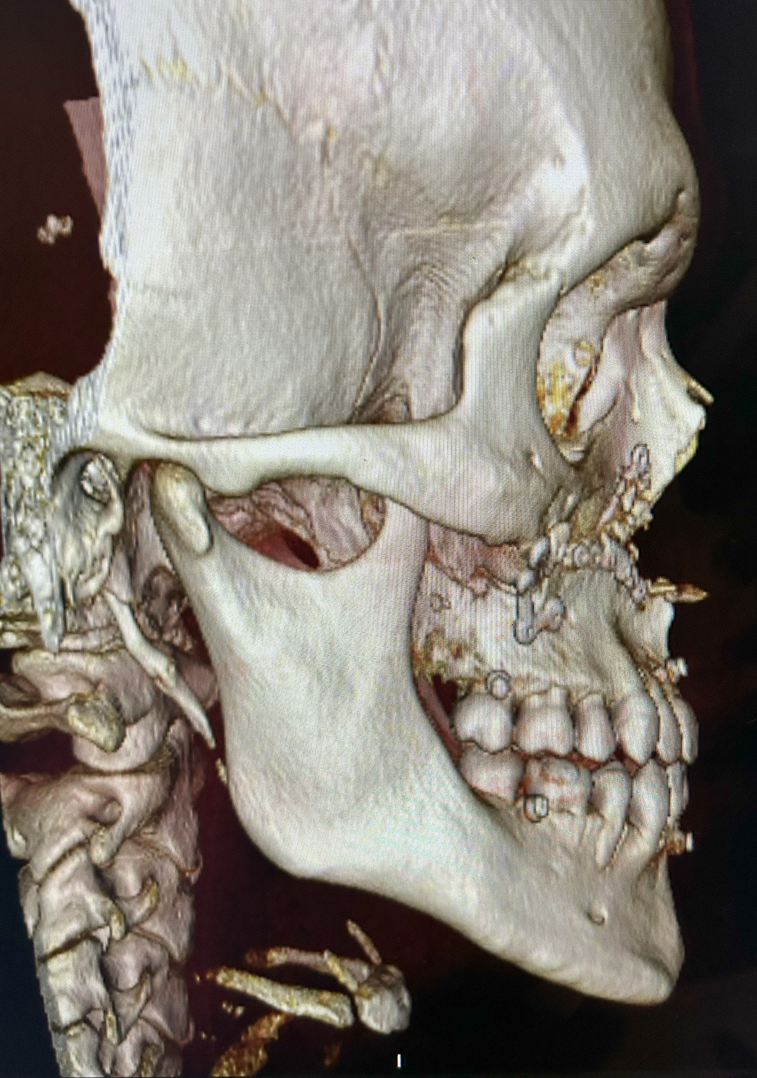 Clinical case 7