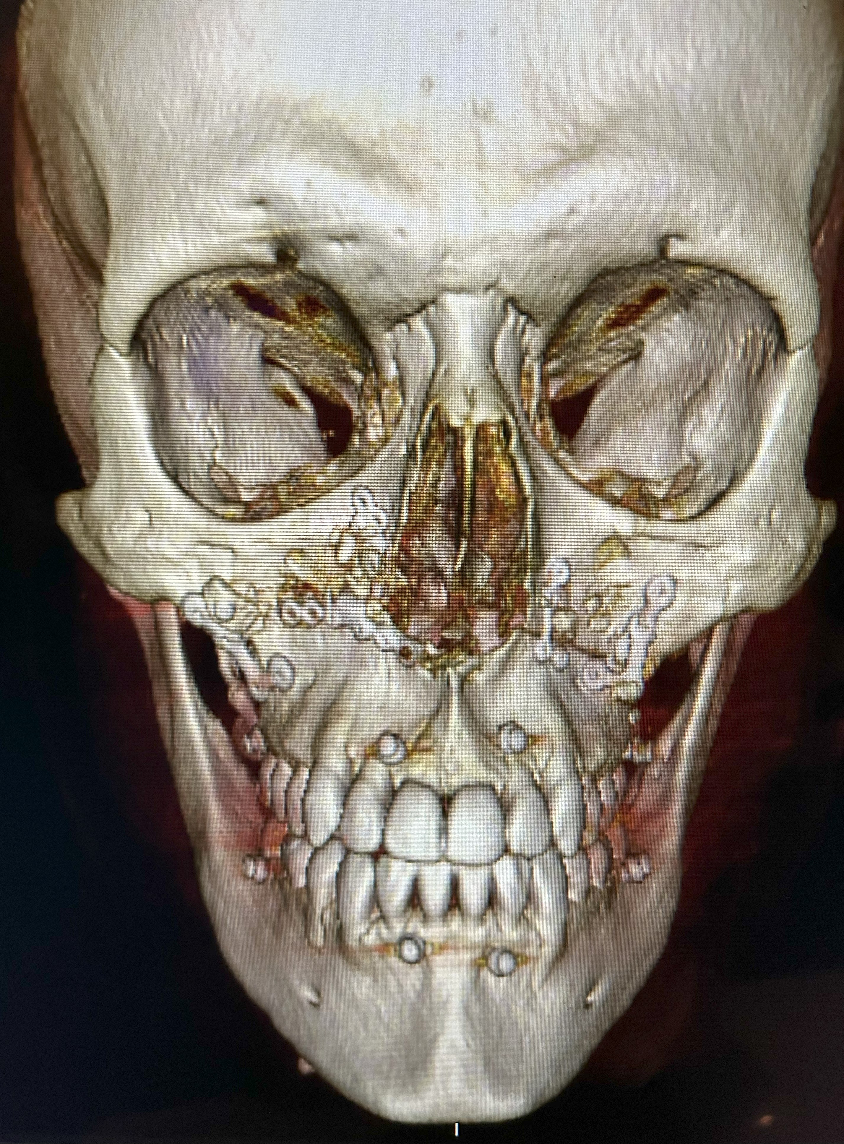 Clinical case 7