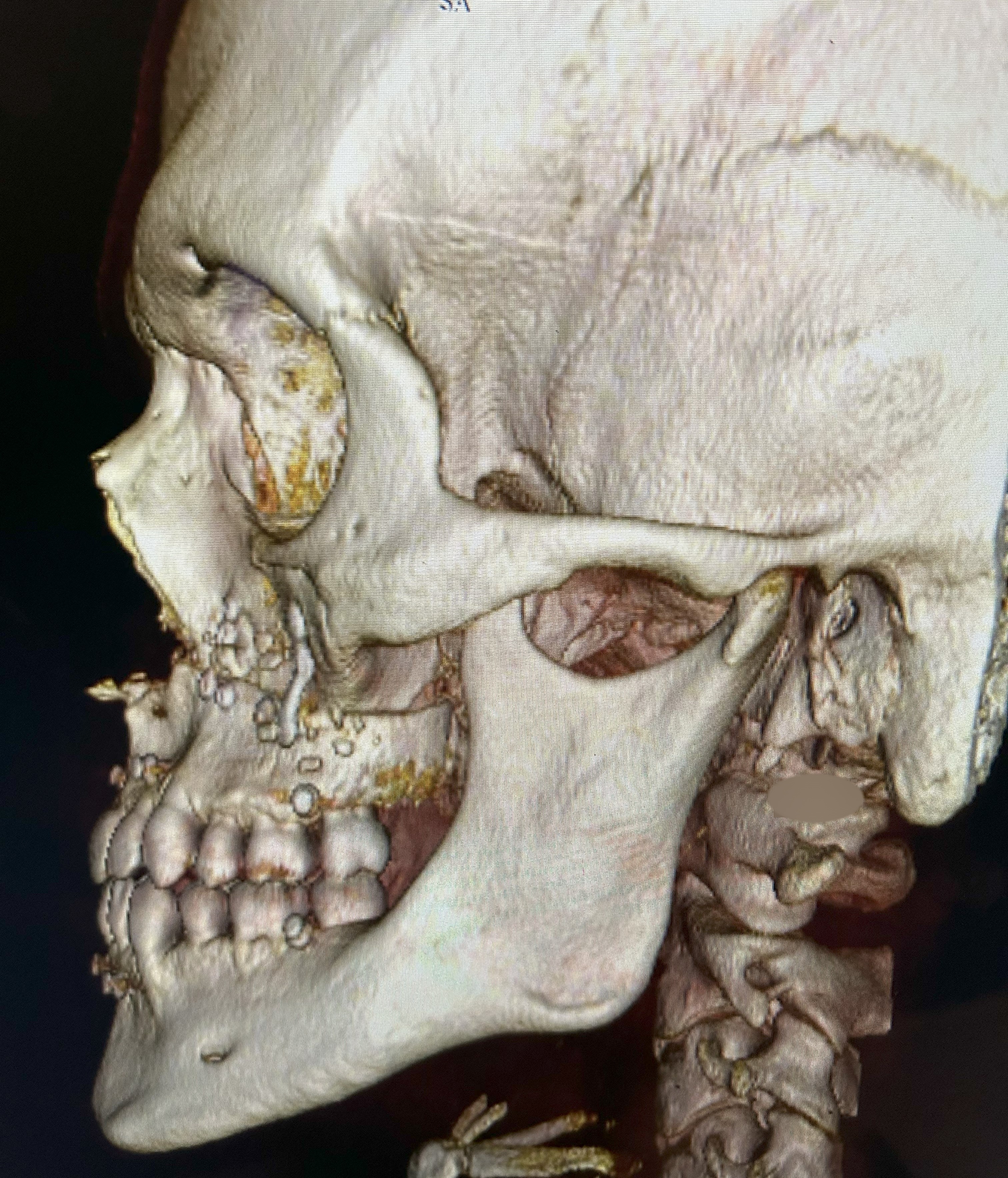 Clinical case 7