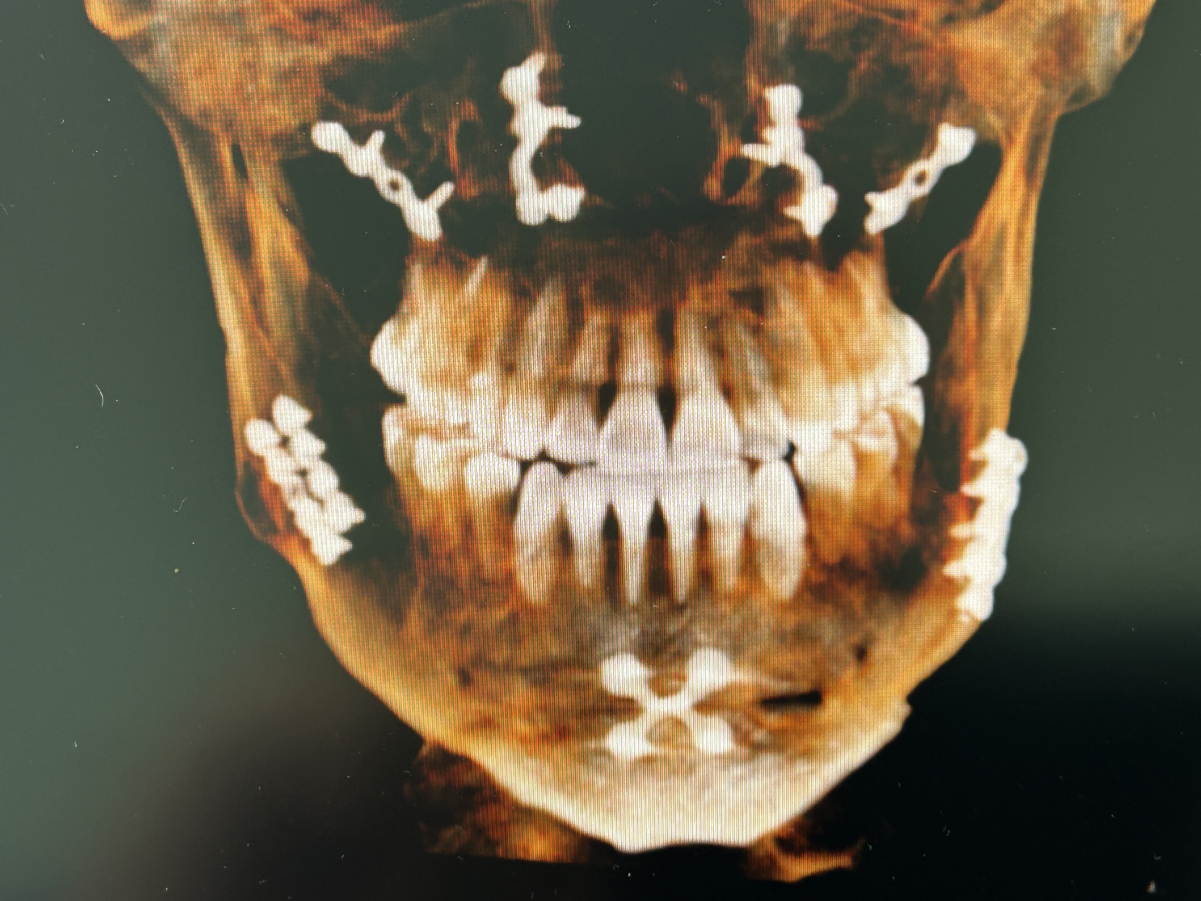 Clinical case