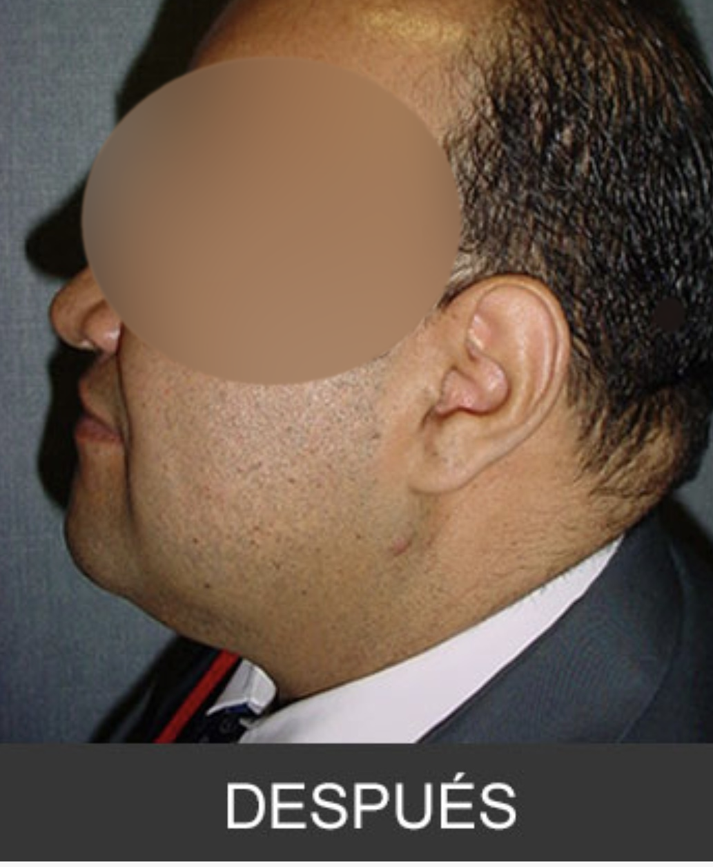 After