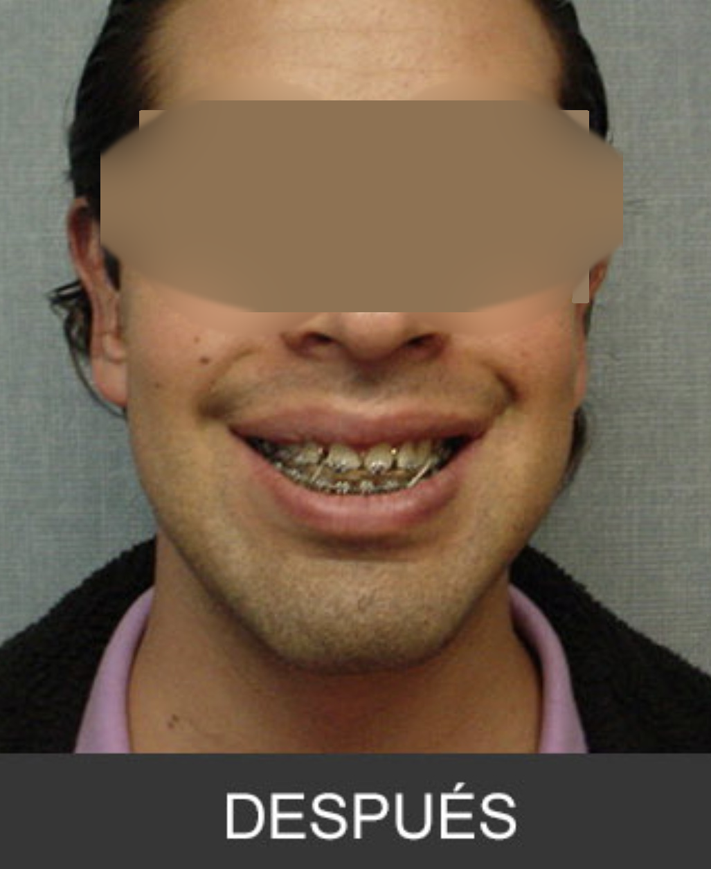 After