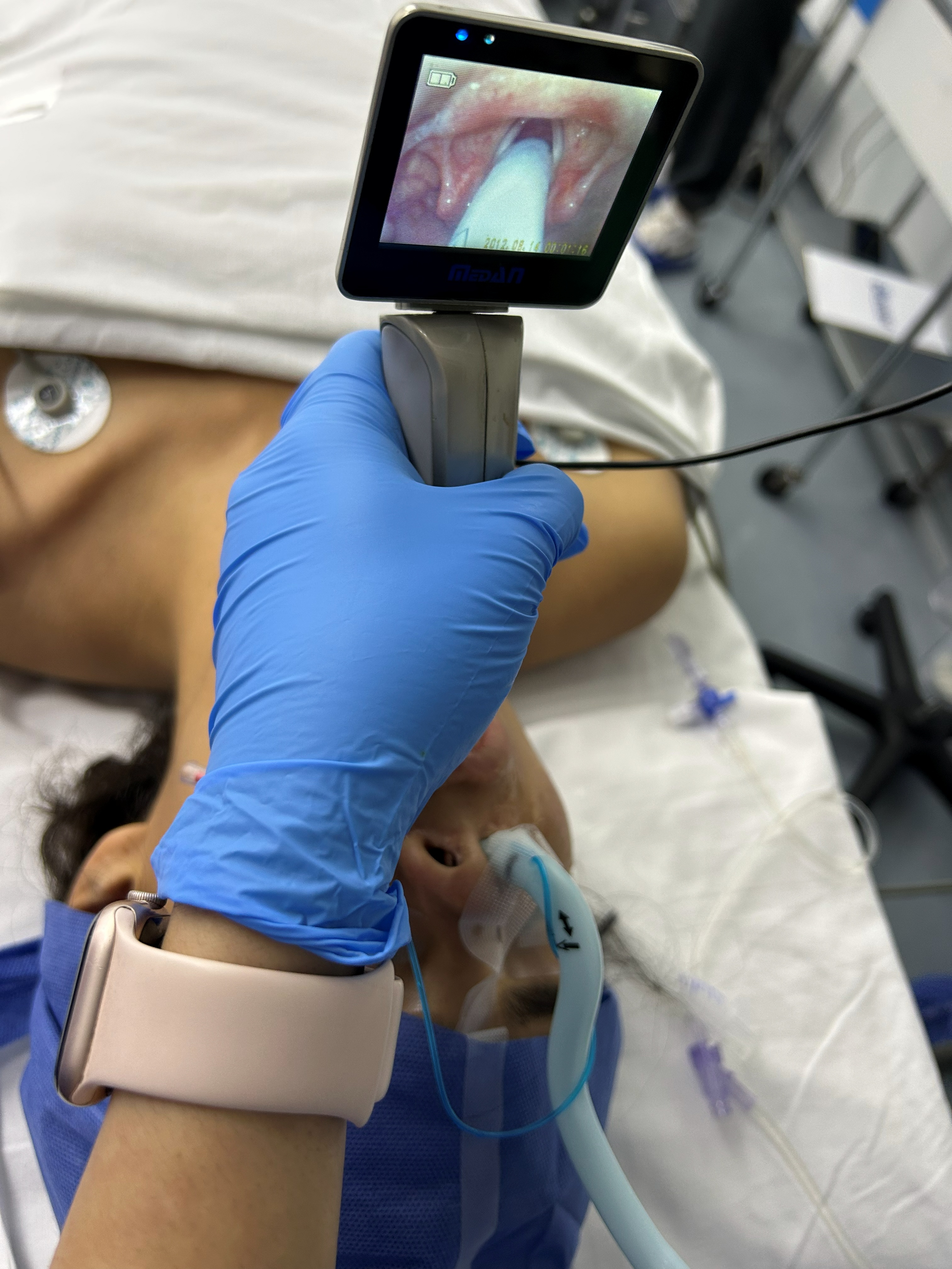 Fiberoptic intubation