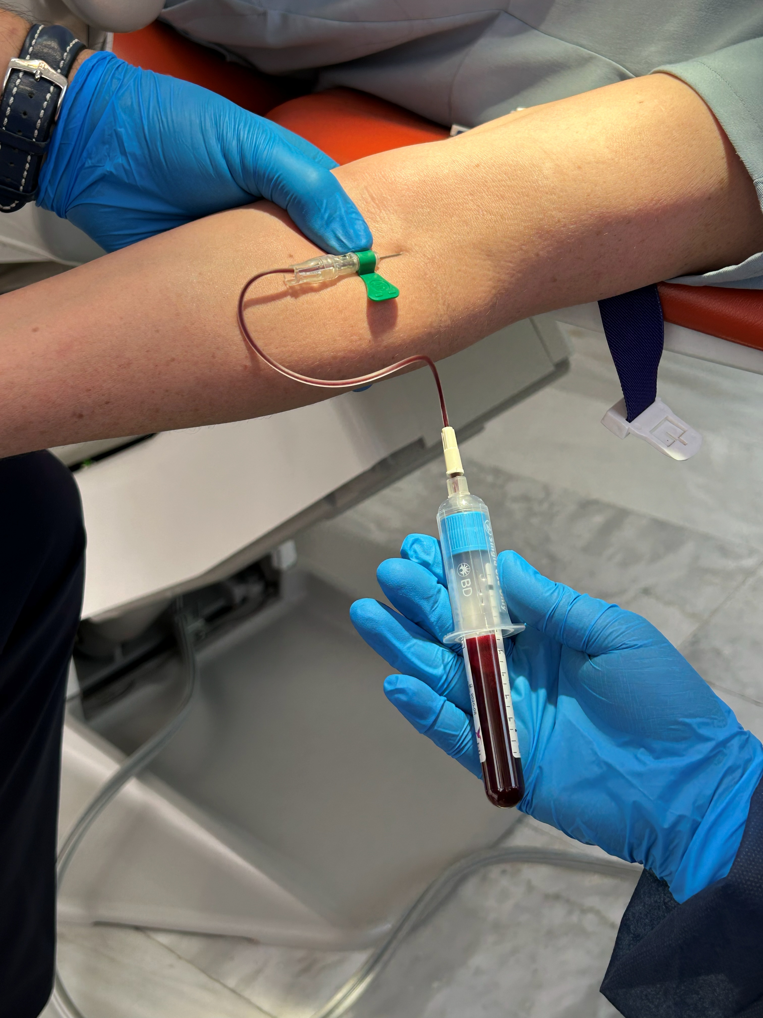 PRP (plasma rico en plaquetas)